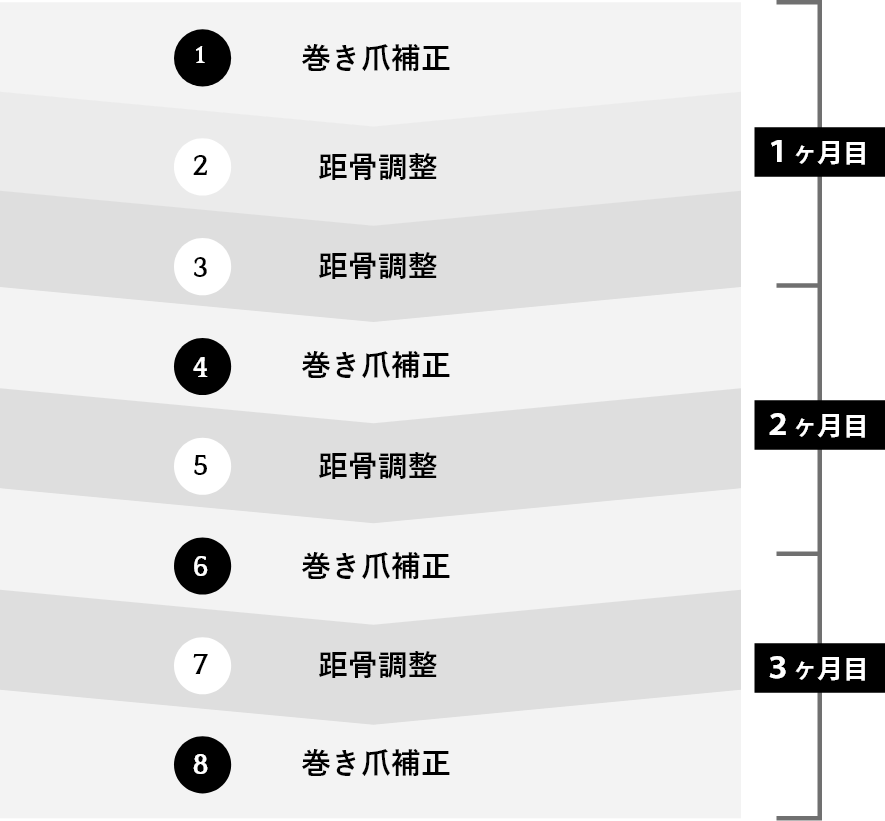 巻き爪根本改善コーススケジュール