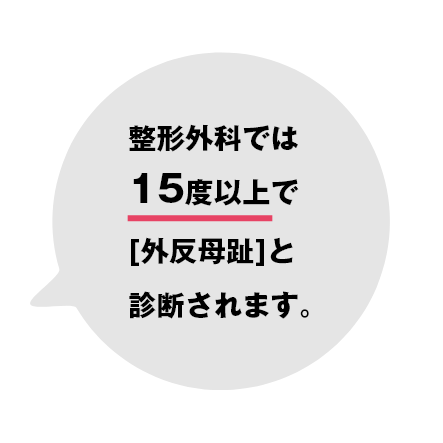 15度以上で外反母趾と診断されます。