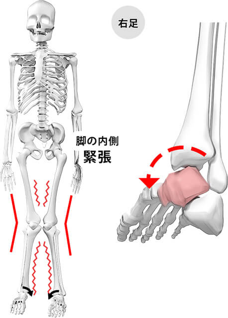 INタイプの状態