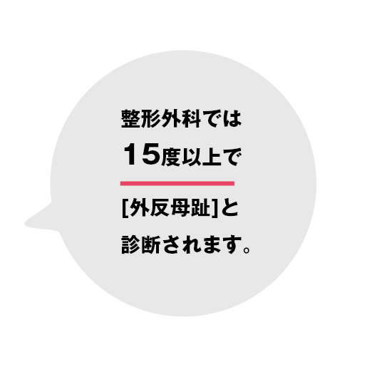 整形外科では15度以上で[外反母趾]と診断されます。