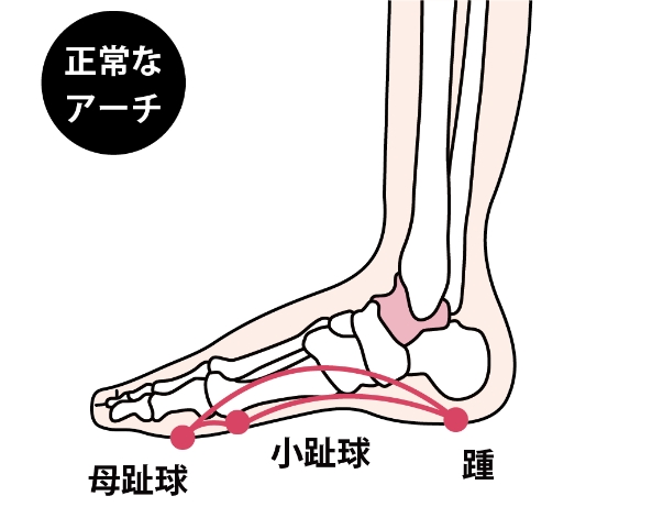 横から見たアーチ