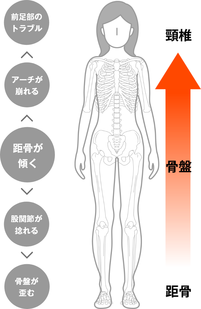 距骨の傾きから広がる症状（図）