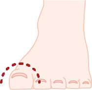 爪のアーチ