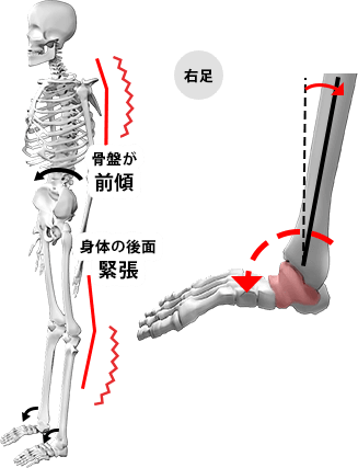 FRONTタイプの状態の図