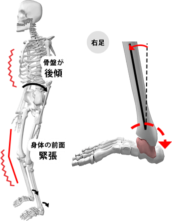 BACKタイプの状態の図