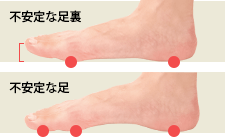 足の指力を自然に鍛えて浮指を解消