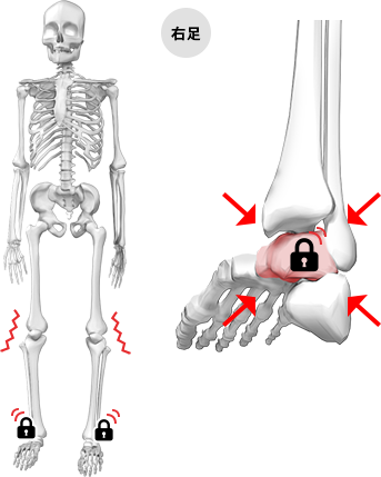 ROLLタイプの状態の図