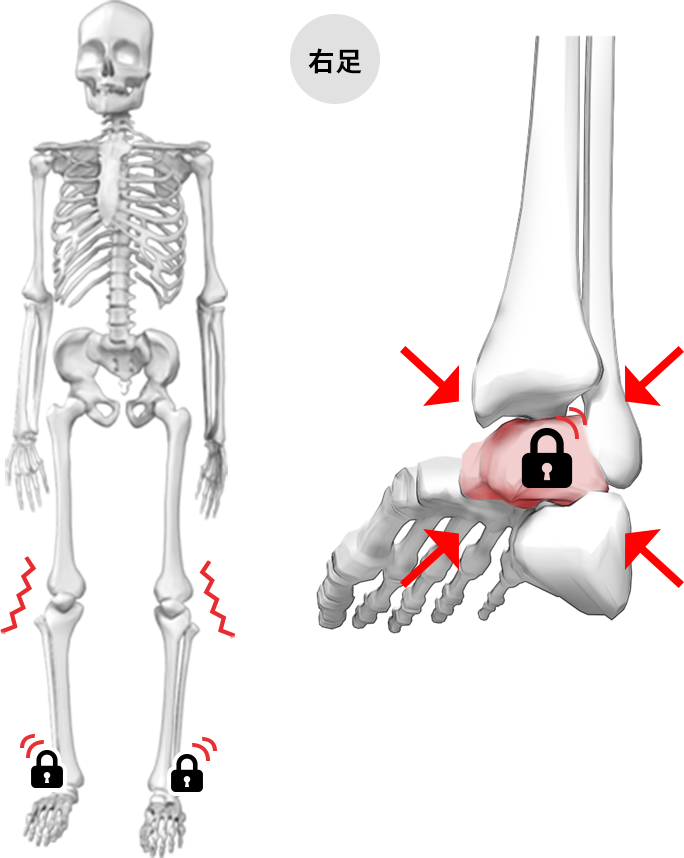 STIFFタイプの状態の図