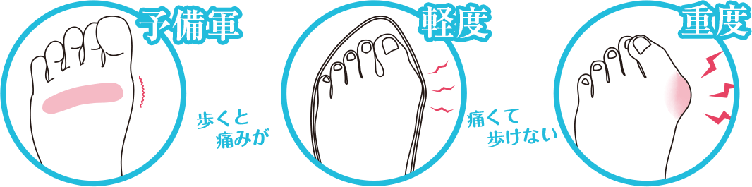 予備軍・軽度・重度