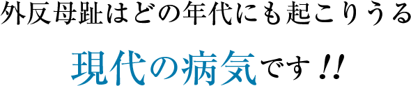 外反母趾はどの年代にも起こりうる現代の病気です!!
