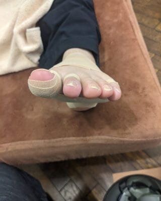 40代なし（越谷市からお越しの方）施術後