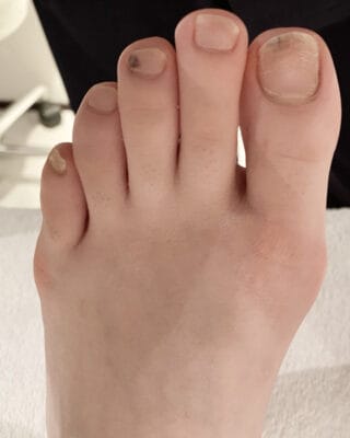 20代女性（千代田区からお越しの方）施術前