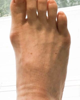 60代女性（目黒区からお越しの方）施術前