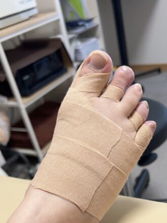 40代女性（京都市）施術後