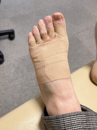 60代女性（京都市）施術後