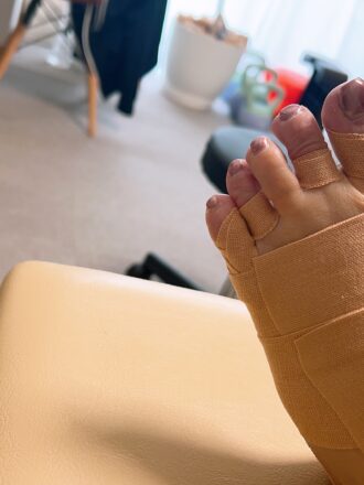 50代女性(京都市)施術後