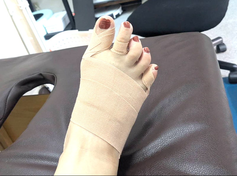 60代女性（河内長野市）施術後