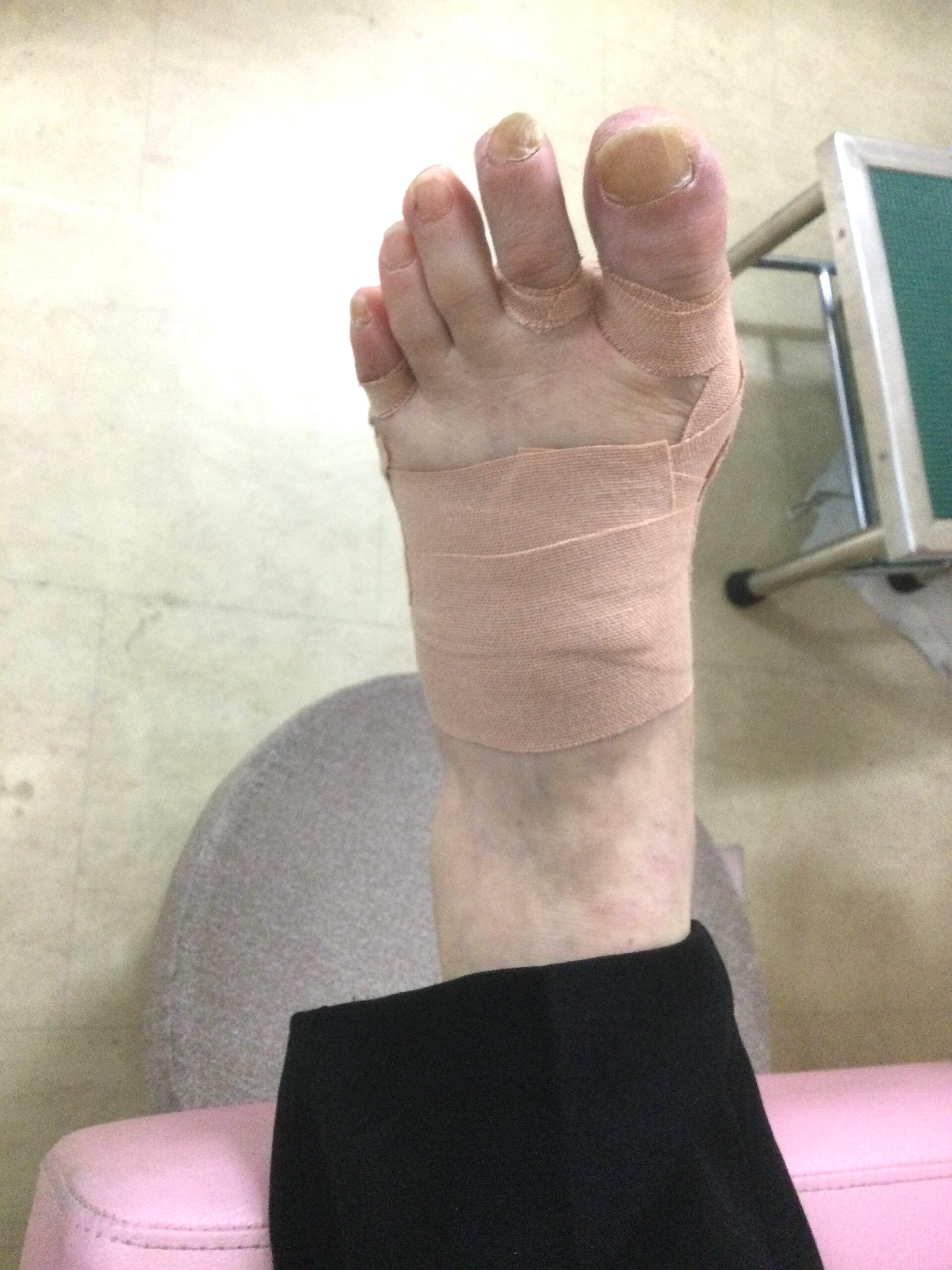 50代女性（東京都八王子市）施術後