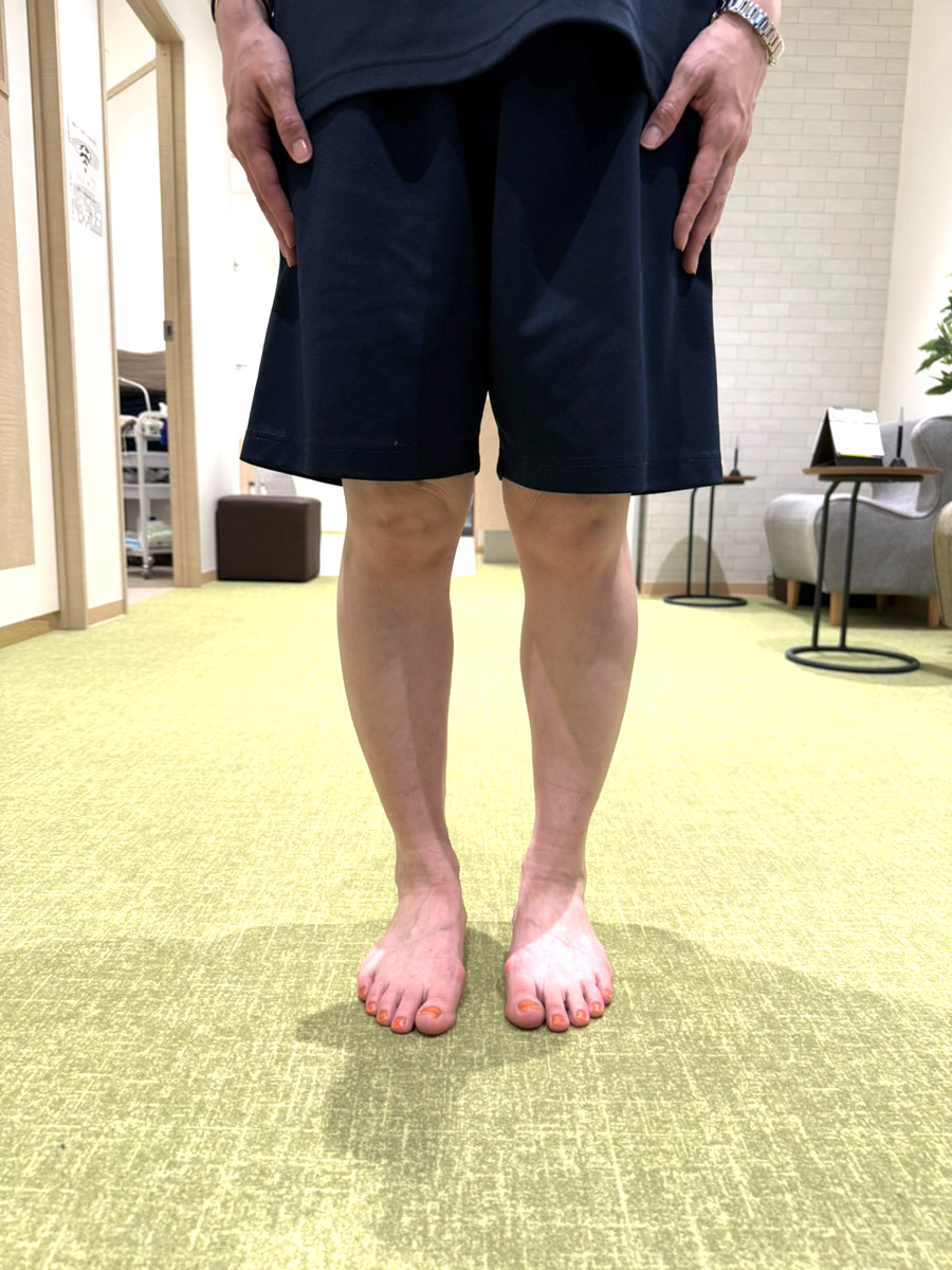 40代女性（国分寺市）施術後