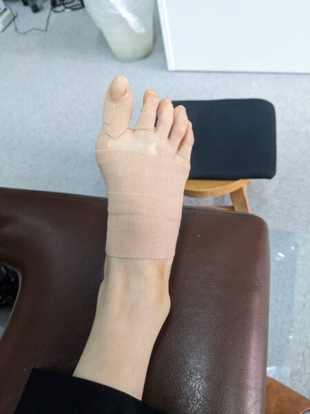 50代女性（大阪市からお越しの方）施術後
