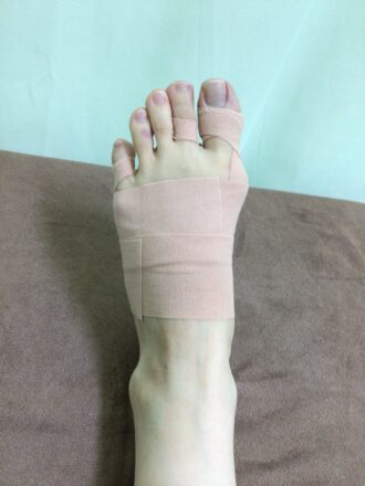 40代女性(葛飾区)施術後