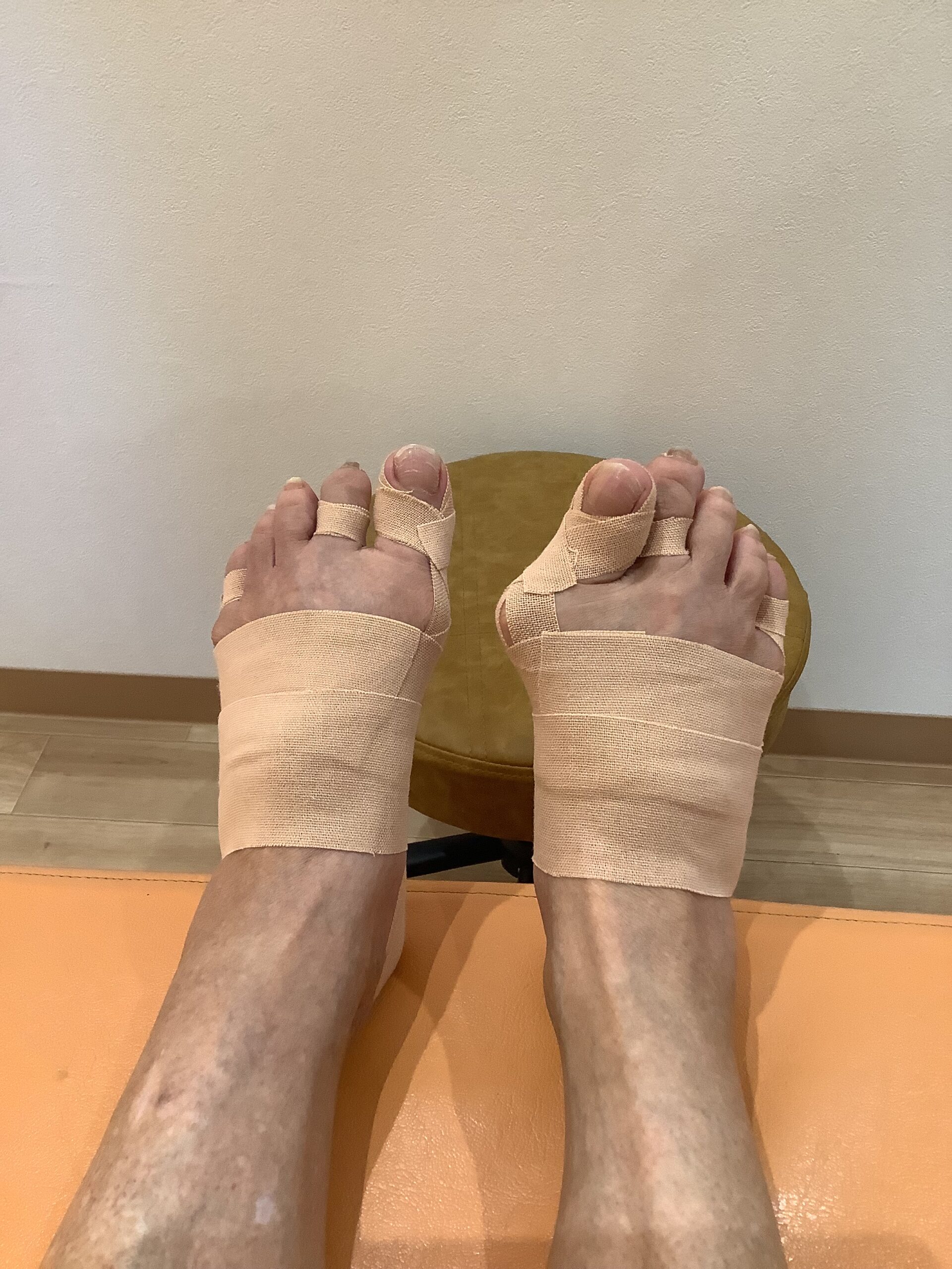 70歳代女性（岡崎市）施術後