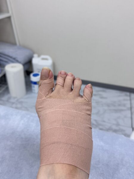 50代女性（江東区からお越しの方）施術後