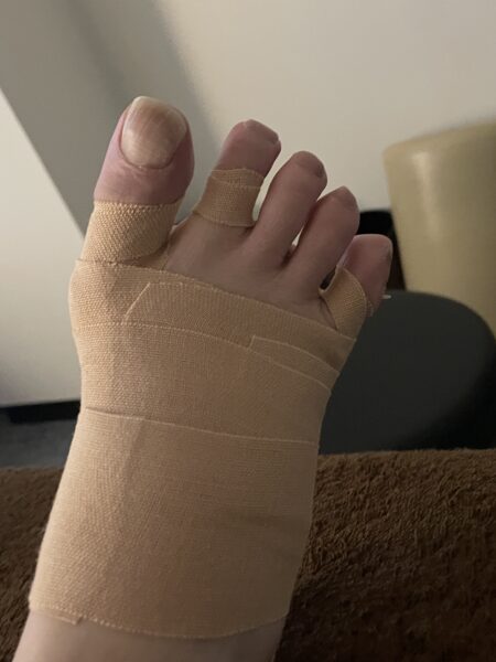 60代女性（日本橋からお越しの方）施術後