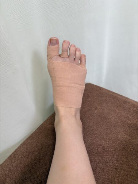 20代女性（柳川市からお越しの方）施術後