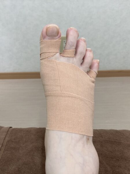 50代女性（筑紫野市からお越しの方）施術後