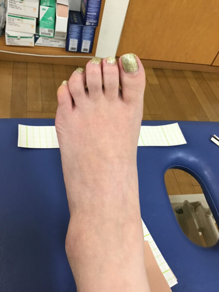 50代女性（練馬区からお越しの方）施術前