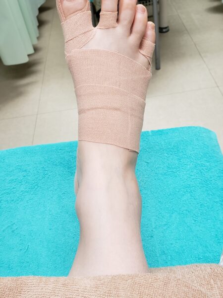 30代女性（大阪市からお越しの方）施術後