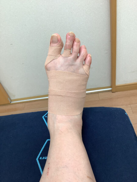 60代女性（西尾市からお越しの方）施術後