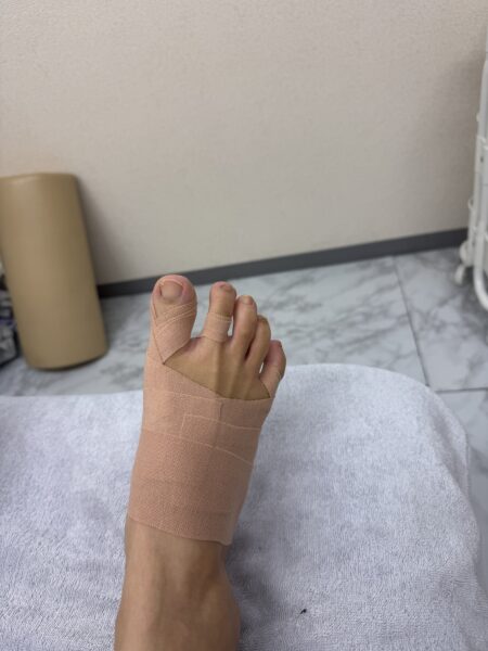 40代女性（墨田区からお越しの方）施術後