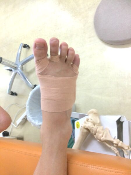男性（八王子市からお越しの方）施術後