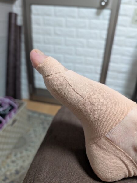 50代女性（高崎市からお越しの方）施術後