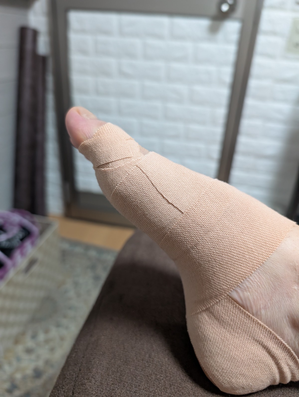 50代女性（高崎市）施術後