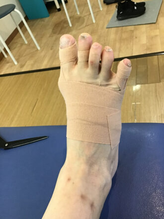 50代女性(練馬区)施術後