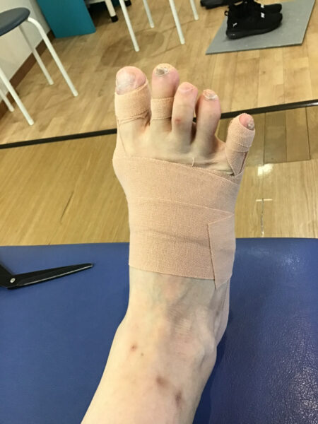 50代女性（練馬区からお越しの方）施術後