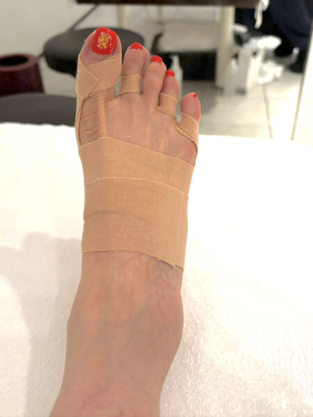 50代女性（赤坂からお越しの方）施術後