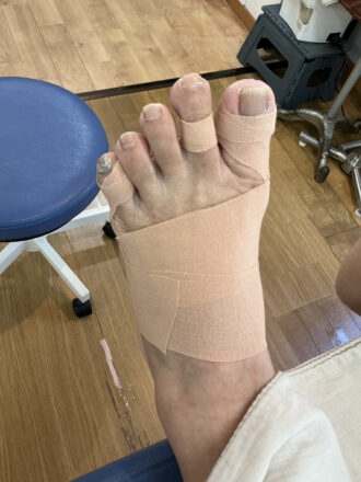 50代女性（練馬区）施術後