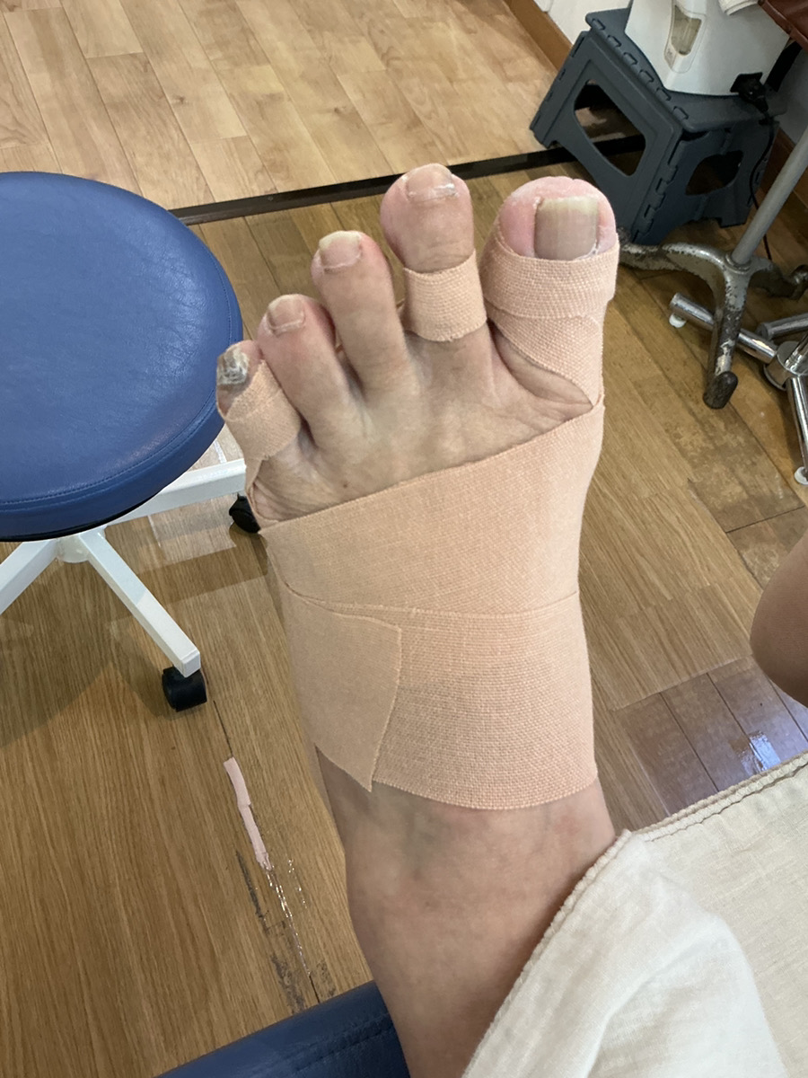 50代女性（練馬区からお越しの方）施術後