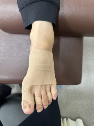 50代女性（京都市）施術後