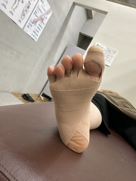 50代女性（大阪市からお越しの方）施術後