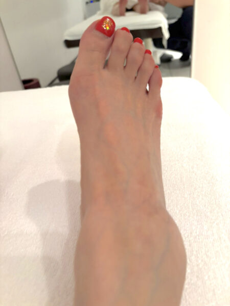 50代女性（赤坂からお越しの方）施術前