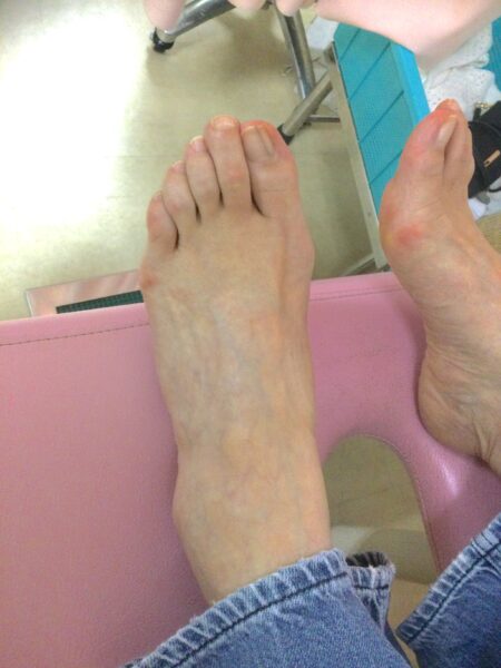 50代女性（八王子市からお越しの方）施術前