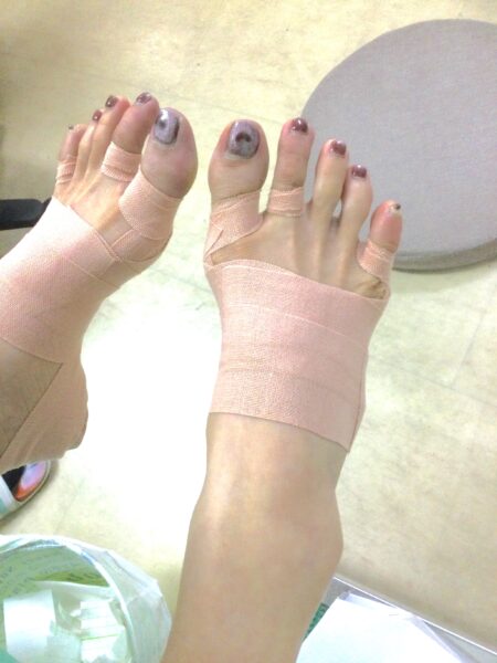 50代女性（日野市からお越しの方）施術後