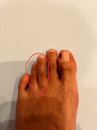 50代男性(大宮市からお越しの方)施術前