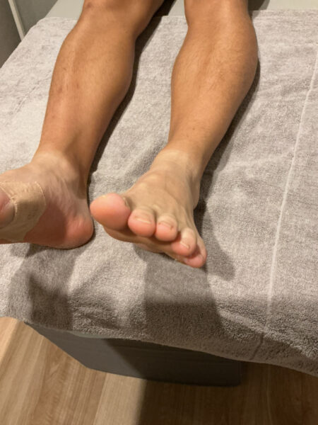 10代男性(浅草からお越しの方)施術前