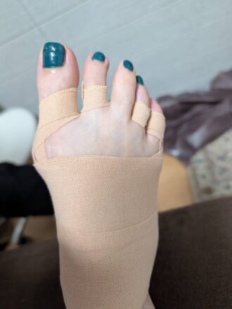 60代女性（富岡市）施術後